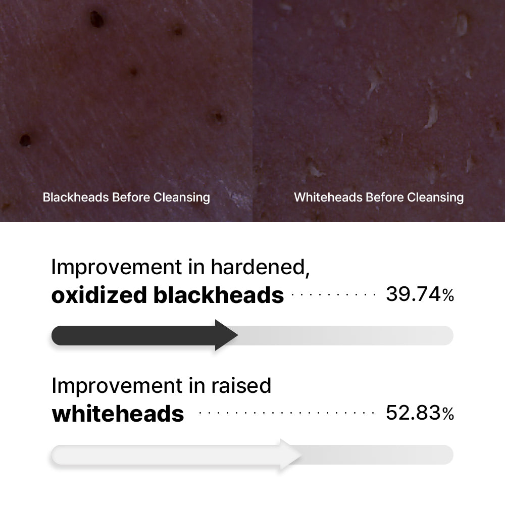 Mild Acidic Clear Cleansing Oil-to-Foam